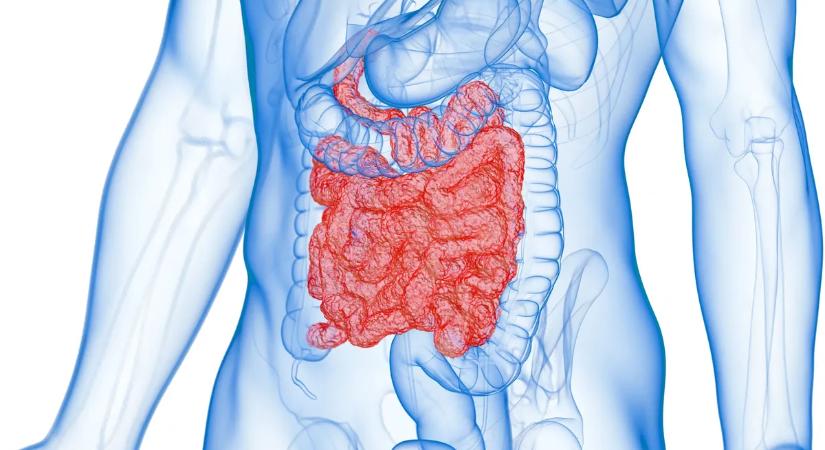 Magyarok tízezrein segíthet az új csodadiéta