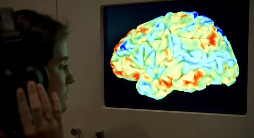Találtak egy rejtett jelet az agyban, előre jelezheti az Alzheimer-kórt