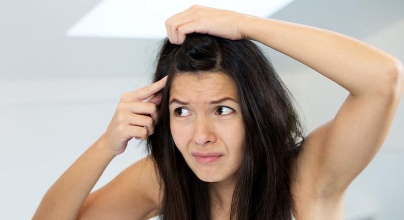 Viszket, hámlik, korpásodik? Télen gyakran ez okozza a fejbőr gondjait