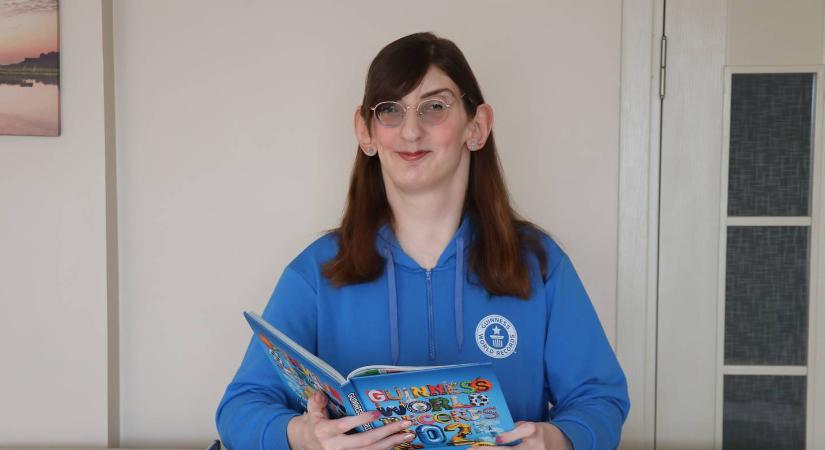 A világ legmagasabb nőjének fájdalmas vallomása: ezek a mindennapi dolgok is komoly nehézséget okoznak neki