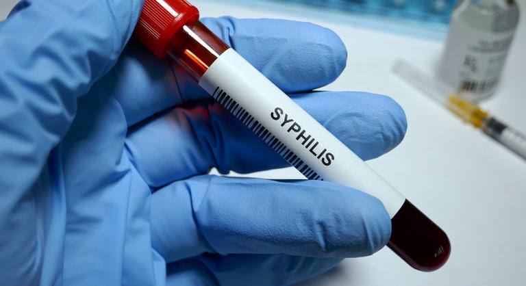 Terjed a szifilisz Tiszavasváriban, figyelmeztették a helyieket