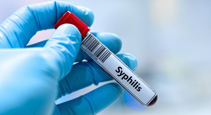 Tiszavasvári polgármestere cáfolta lapunknak, hogy egyre több lenne a szifiliszes beteg