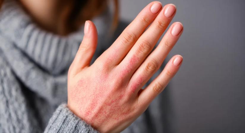 Leállt a távfűtés Kazincbarcikán, 500 lakásban melegvíz sincs