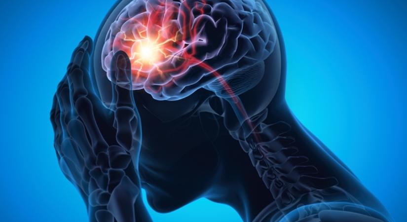 Ez a stroke legkorábbi jele: már hetekkel előre jelezheti a szélütés bekövetkeztét, ne hagyd figyelmen kívül