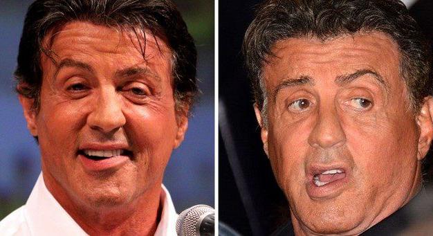 20 színész, akik szépséghibájuk ellenére úgy tökéletesek, ahogy vannak