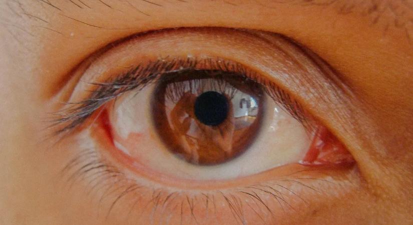 Ez az alattomos betegség több embert érinthet, mint gondolnánk – a legtöbben túl későn veszik észre