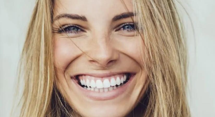 Szép mosoly, magabiztos kisugárzás – így őrizd meg fogaid egészségét és szépségét