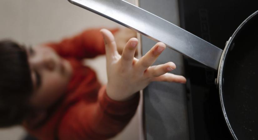 Forró víz borult egy négyéves kisfiúra, életveszélyes égési sérüléseket szenvedett
