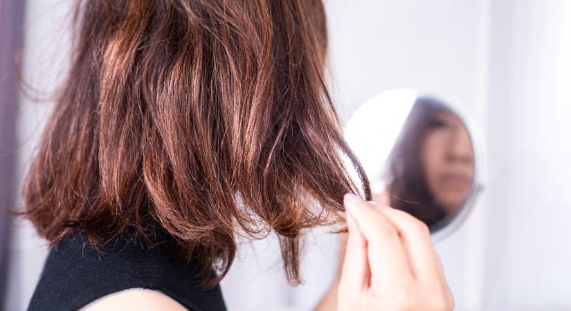 Rejtett betegségekről árulkodhat a hajunk állapota