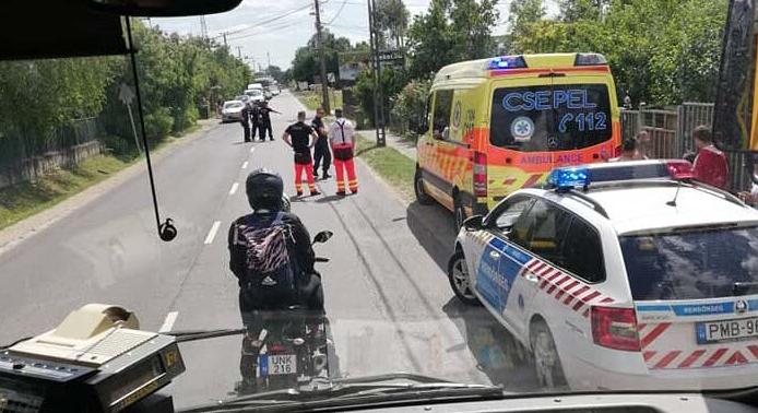 Kutyatámadás Vácon: egy pár hónapos csecsemő fejét marcangolta szét a család kedvence Vácon, életveszélyben van a kisbaba