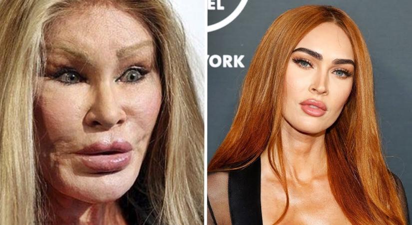 Színésznők, akik már biztos megbánták, hogy plasztikáztatták az arcukat (Fotók!)