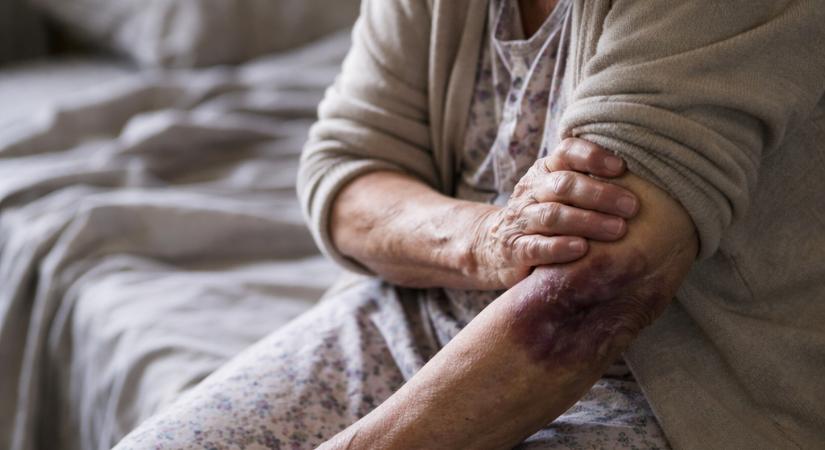 Saját anyját bántalmazta