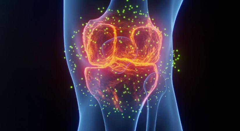 Az ízületi fájdalom legjobb gyógyszere nem az, amire gondolsz