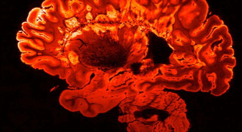 Riasztót mondott a világ egyik legbefolyásosabb bankára – Nagy baj lehet ebből a trendből, lassítani kellene