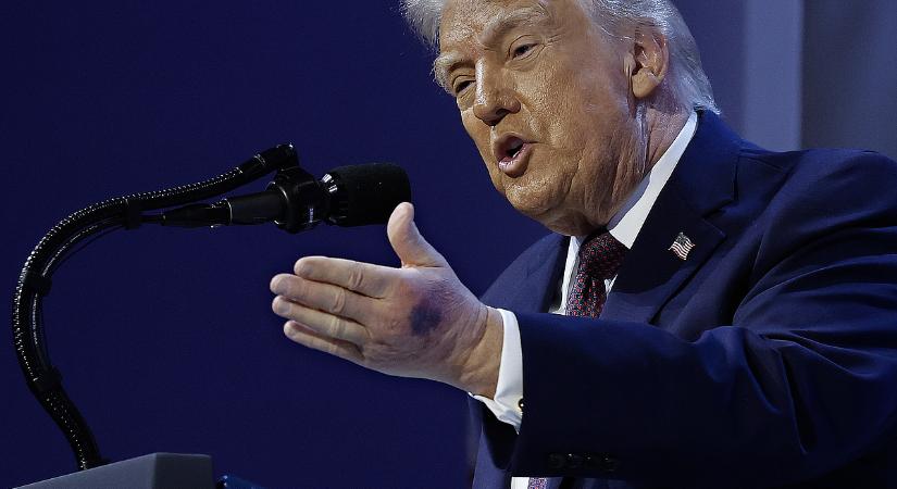 Furcsa magyarázat érkezett Donald Trump kézfején látható kék foltra