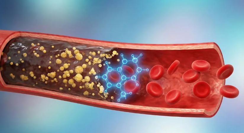 Magyarok tömegeit mentheti meg: itt az új fegyver a szívroham és a stroke ellen