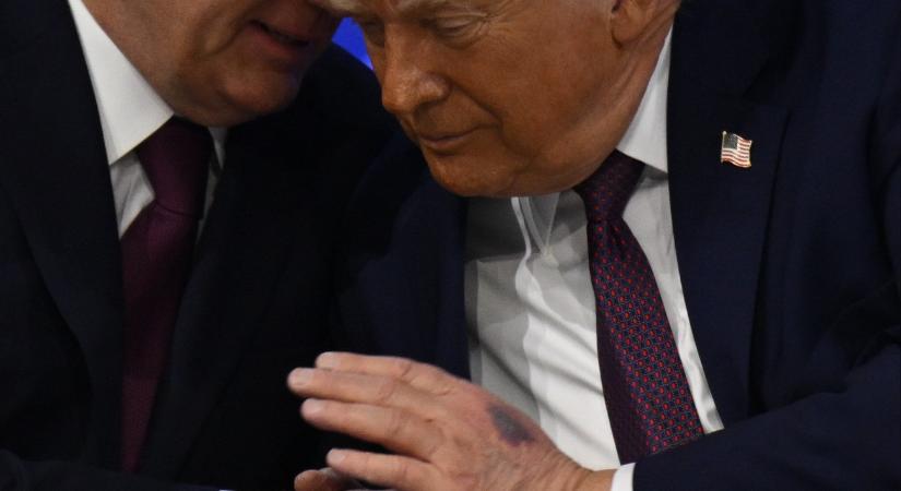 Újrakezdődtek a találgatások, bekékült Donald Trump keze