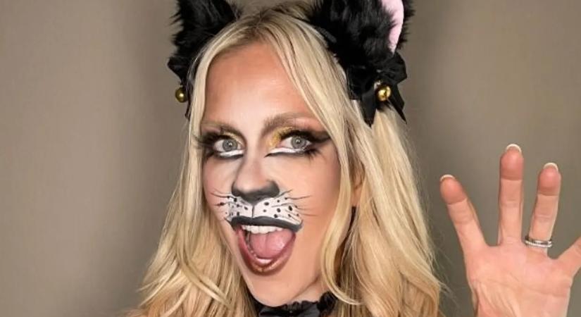 Felrobbant a mellimplantátuma – műteni kellett a Big Brother sztárját