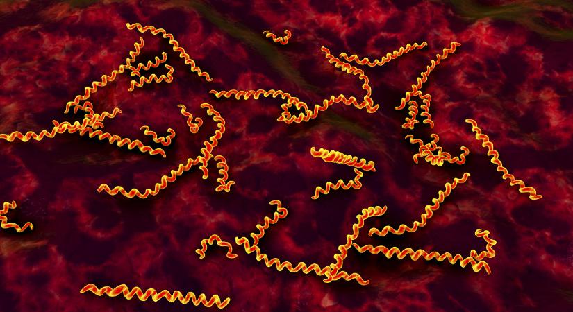 A szifilisz már 5000 évvel korábban megjelenhetett, mint eddig hitték