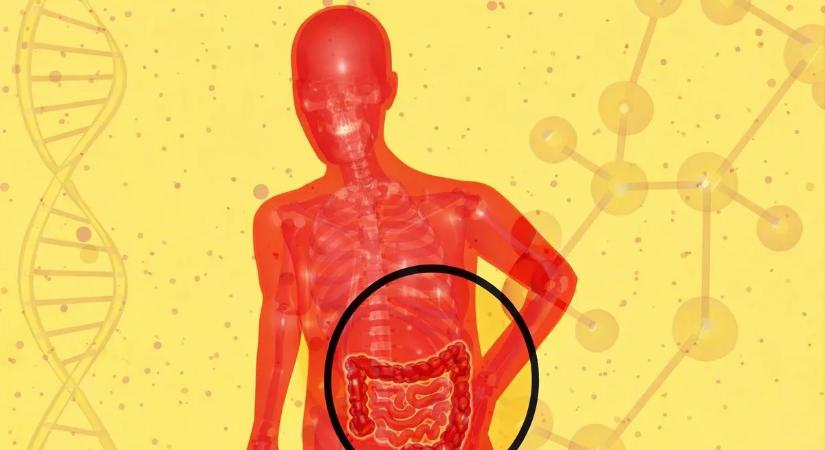 Ezekkel az ételekkel tönkreteszi bélrendszerét