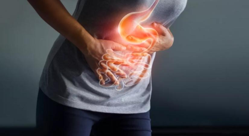 Nem a mozgáshiány az első számú rizikó: ez növeli leginkább a bélrák kialakulásának kockázatát