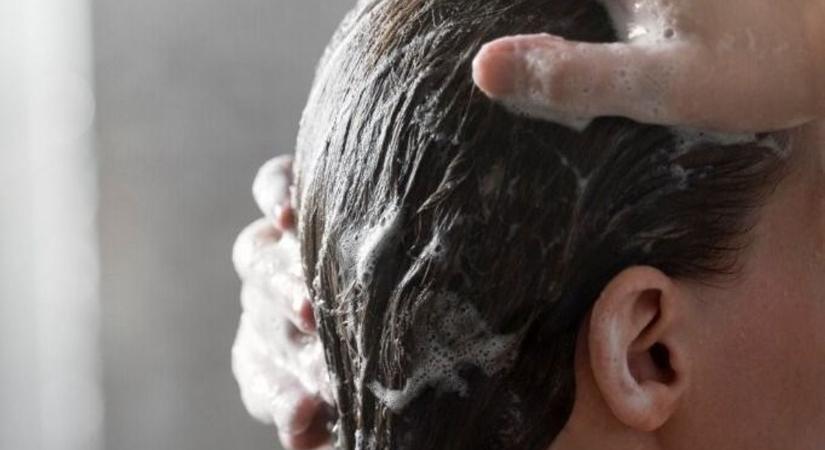 Télen dől el, milyen lesz a hajad tavasszal! Itt az ideje cselekedni, szakember mondja el, mit tehetünk!