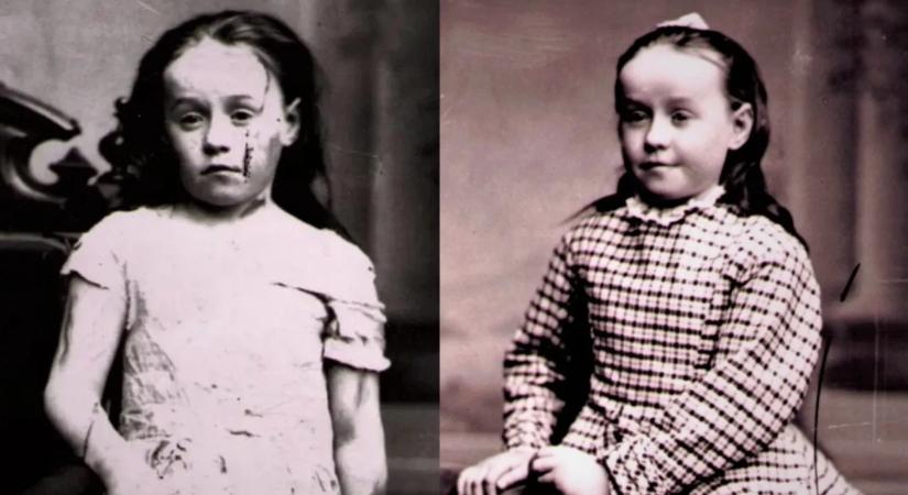 Mary Ellen Wilson: a megkínzott kislány, akinek a szenvedése törvényt változtatott