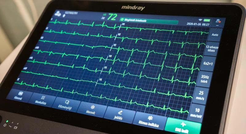 Digitális EKG-val bővült a debreceni sürgősségi paletta