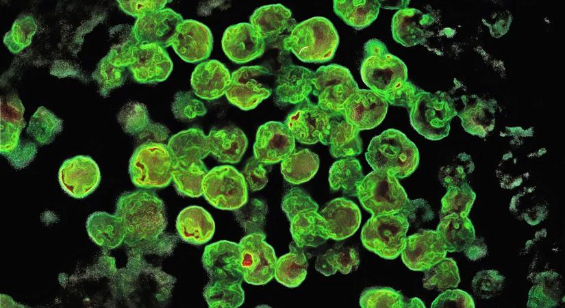 Nagy a baj: halálos víz folyhat a csapból és semmi sem védheti meg