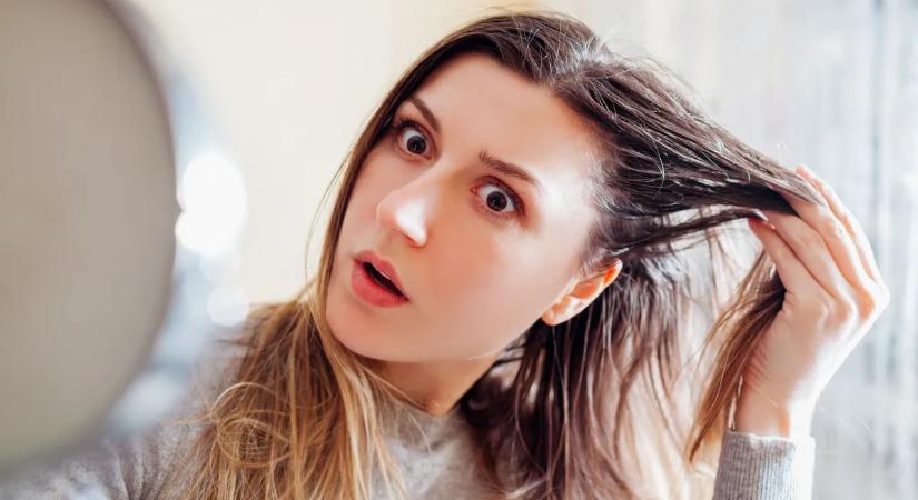 Őrjítően zsíros a hajad? Hajgyógyász mondja el, mit rontasz el nap mint nap – Így orvosolhatod a problémát könnyedén