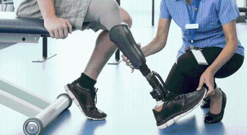 Ukrajnában gondok vannak a művégtagok készítésével – szociálpolitikai miniszter