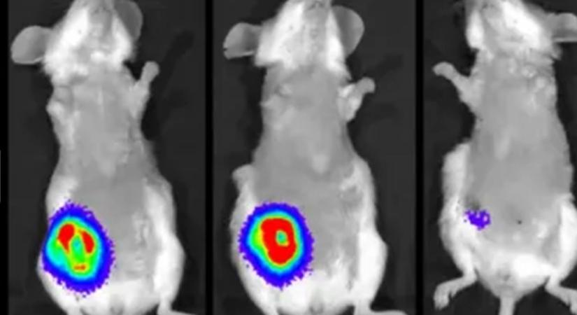 Pécsiek közreműködésével születhet meg a kiemelkedően hatékony rákgyógyszer