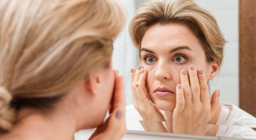 Gyönyörű bőr télen: A drága krém nem elég, ezeket az ételeket edd a ráncok, pattanások és a kiszáradás ellen