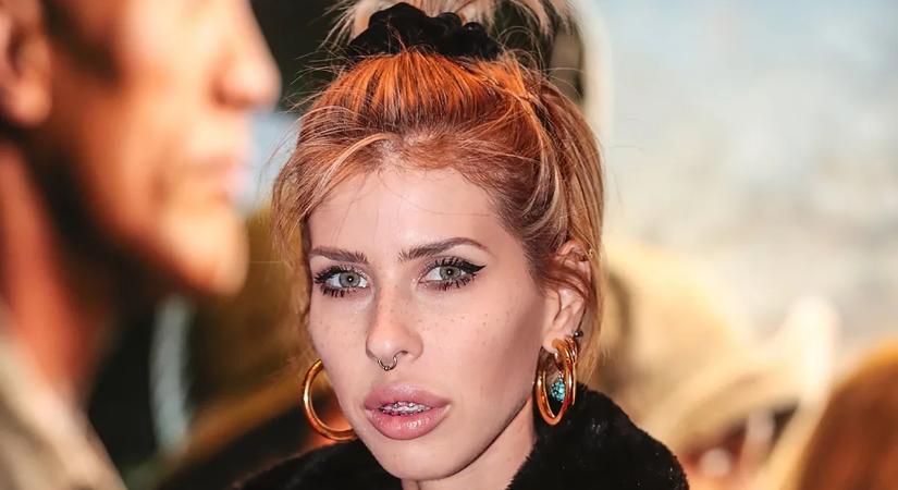 Életveszélyes állapotba került a magyar modell