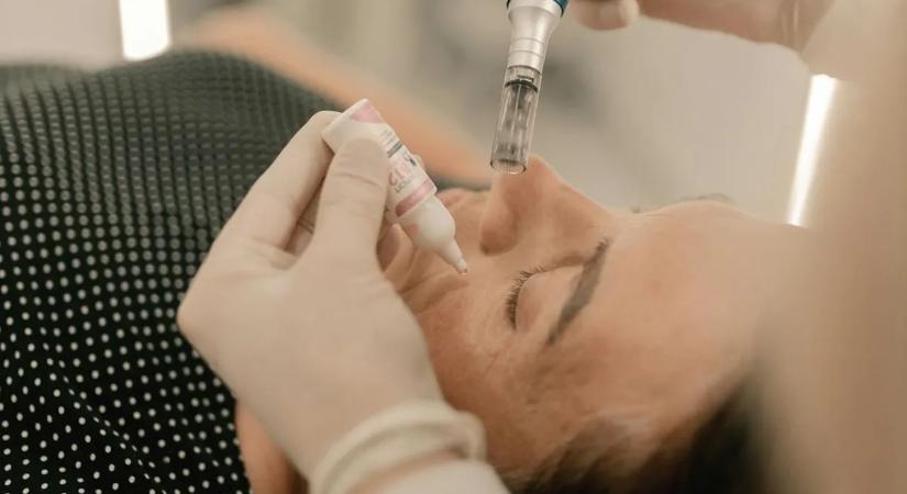 Sokkoló átváltozás: több százezer dollárt fizettek ezért az arcért