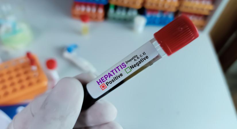 Járványügyi figyelmeztetés: drámaian gyorsan terjed a súlyos betegség Magyarországon