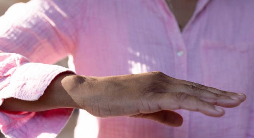 Fiatalon betegít meg, dolgozni sem lehet: ezért lenne szükség adókedvezményre