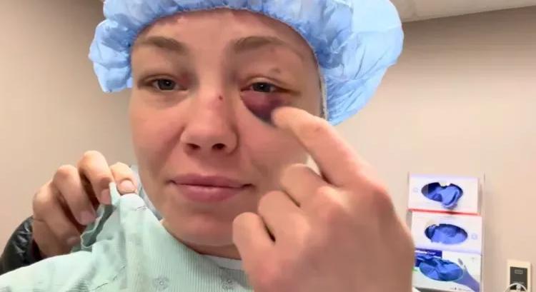 Rose Namajunast műteni kellett, mert a UFC 324-en többször is szemébe nyúltak