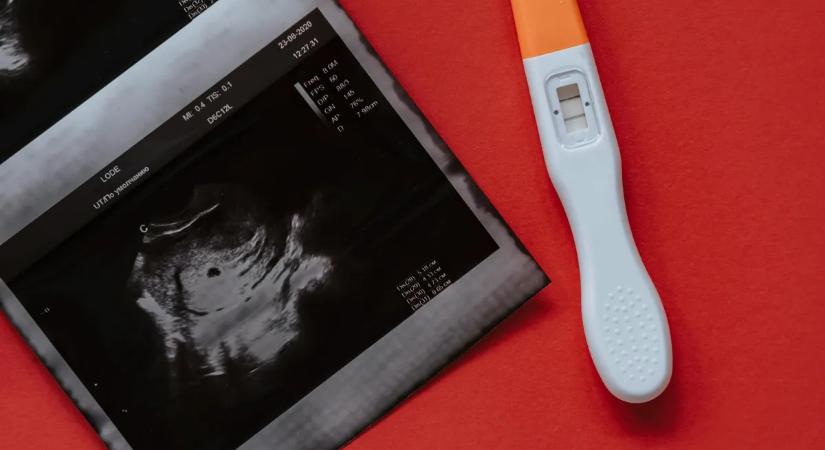 Hosszú küzdelem után kisbabát vár a magyar színésznő