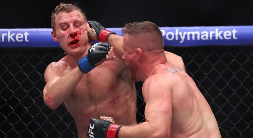 Brutális arcsérüléseket szenvedett a UFC angol fenegyereke – képek