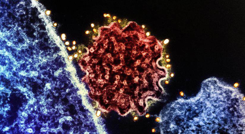 India után több ország is reptéri szűréseket vezetett be a Nipah vírus terjedésének megállítására