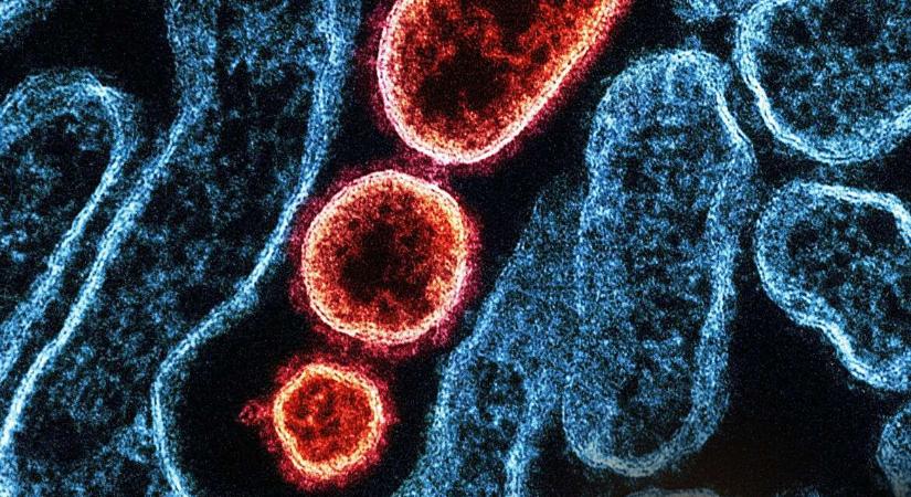 Mit lehet tudni a most felbukkant Nipah-vírusról?