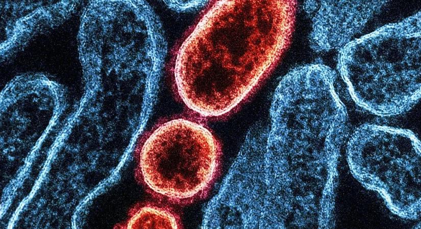 Halálos szupervírus terjed, szigorítanak az ellenőrzéseken