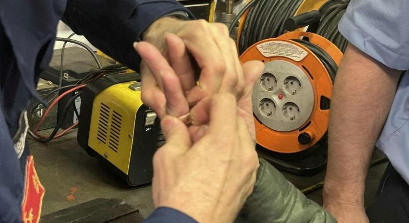 Fűrésszel vágták le a gyűrűt a nő ujjáról