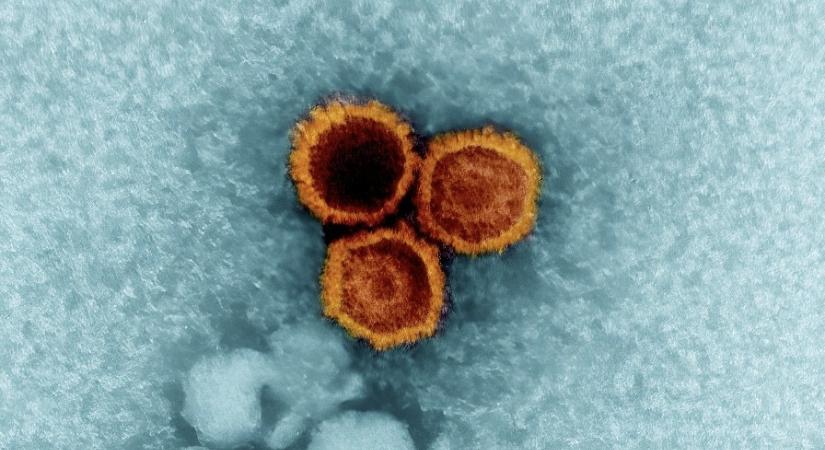 Kiderült miért csak egyes embereknél vált ki súlyos megbetegedést az Epstein-Barr-vírus