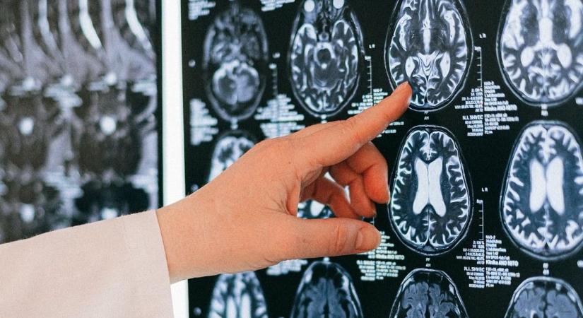 Szörnyű rekord: egy nap alatt 187 rohama volt az 5 éves kislánynak