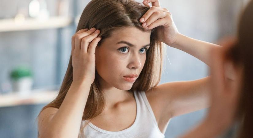 Így állapítsd meg, kóros-e a hajhullásod: ha elbuksz ezen az otthoni teszten, azonnal irány az orvos!