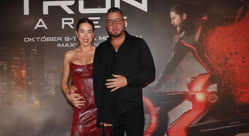 Ismét kórházban kötött ki Zámbó Krisztián párja: "Rosszul forrt volna össze a csont!"