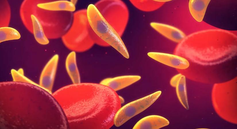 Milliók agyában él egy parazita – és most kiderült, hogy sosem alszik!