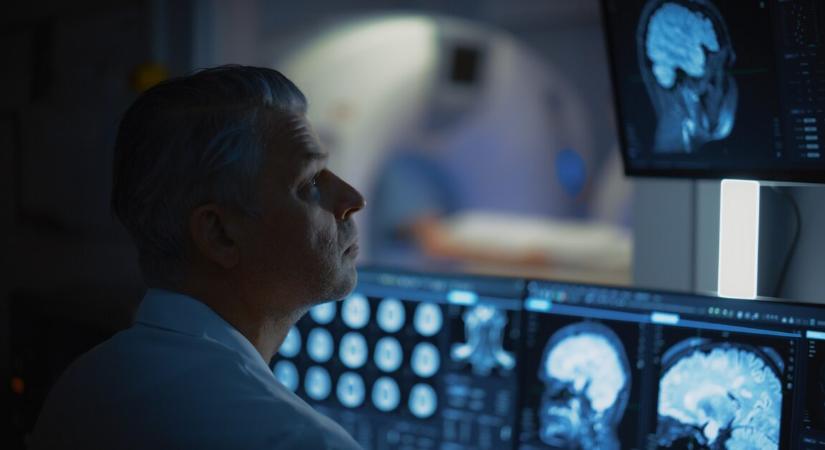 Az agydaganat évekkel korábban kialakulhat, mint hogy az orvosok észrevennék